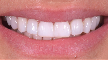 Advanced Dentistry - After