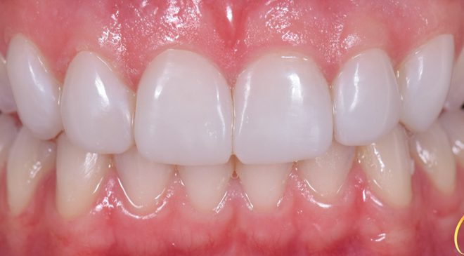 Advanced Dentistry - After