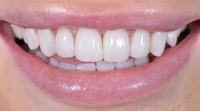 Advanced Dentistry - After