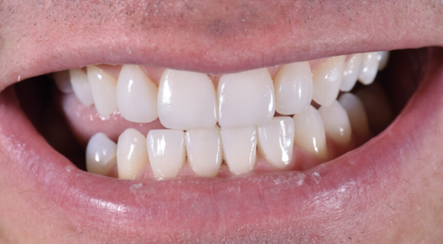 Advanced Dentistry - After