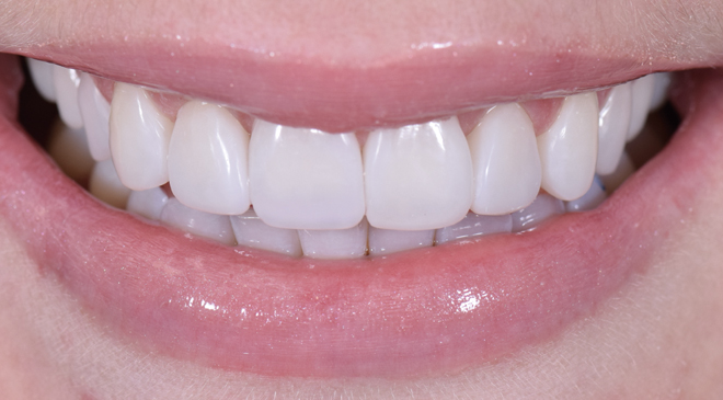 Advanced Dentistry - After