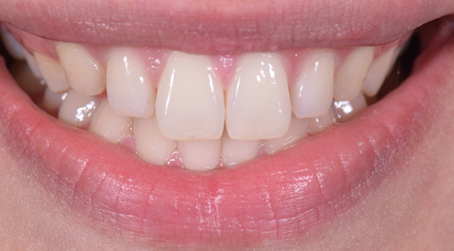 Advanced Dentistry - Before
