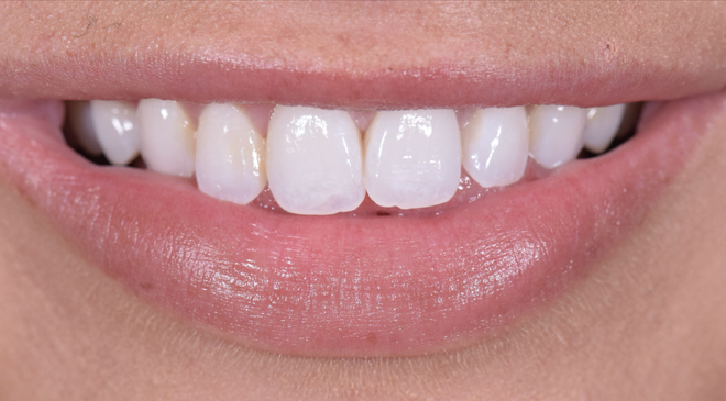 Advanced Dentistry - Before