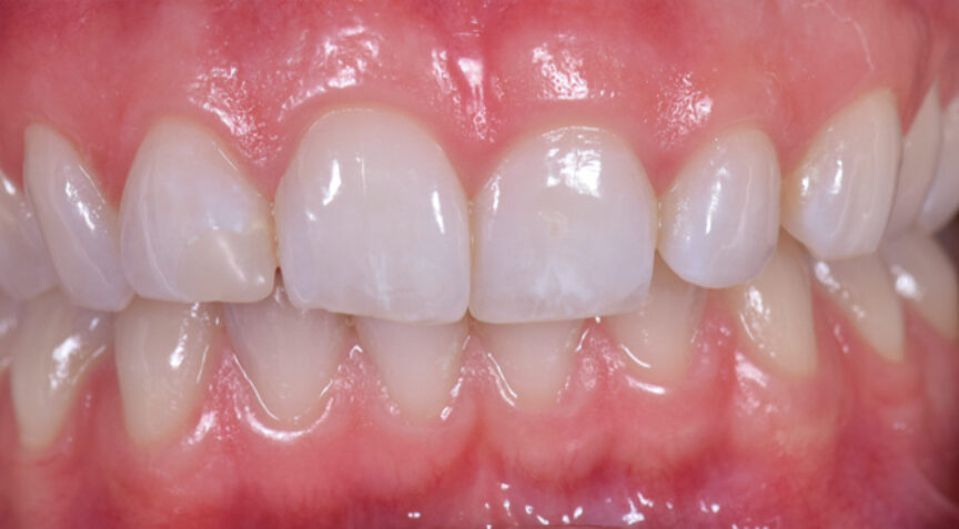 Advanced Dentistry - Before