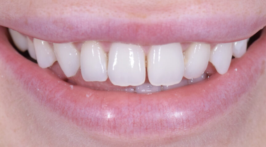 Advanced Dentistry - Before