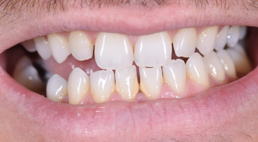 Advanced Dentistry - Before