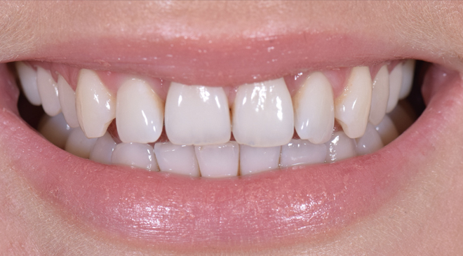 Advanced Dentistry - Before