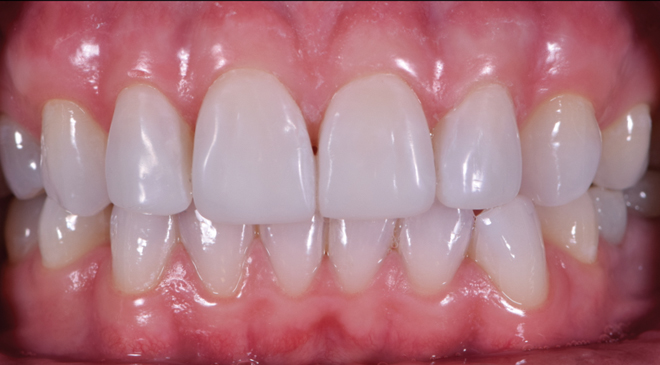 Advanced Dentistry - After