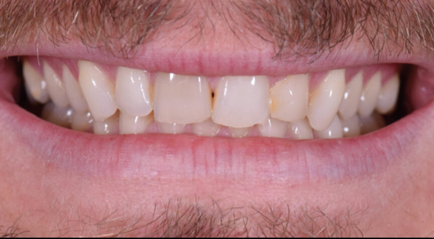 Advanced Dentistry - Before