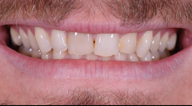 Advanced Dentistry - Before